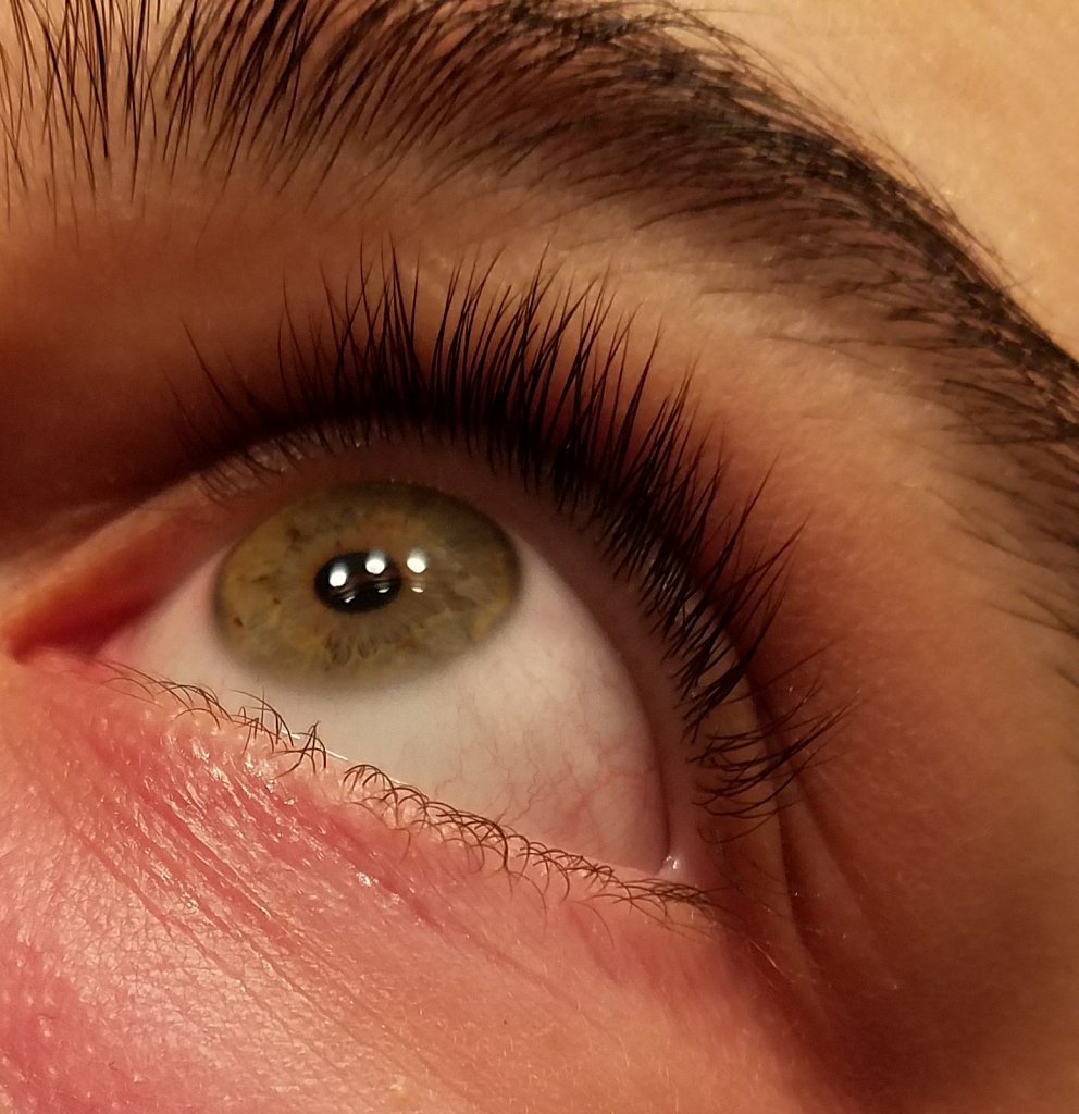 My eye